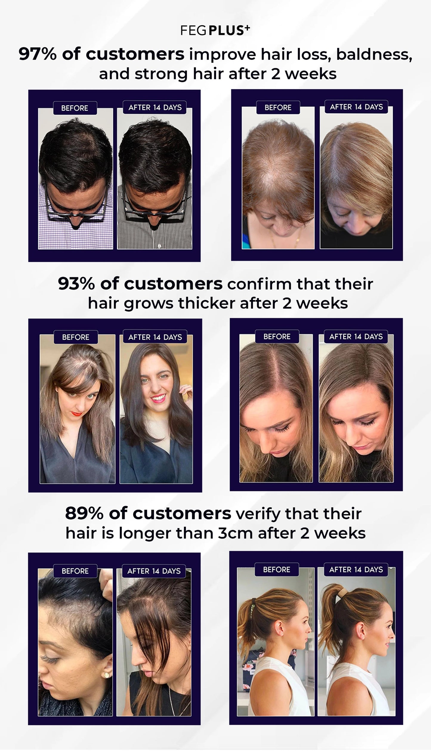 Most Viral FEG Plus Hair Growth Spray